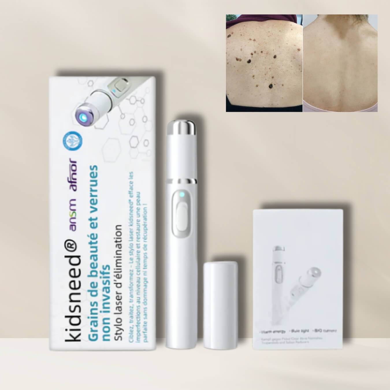 Kidsneed - Stylo Laser non invasif pour l'élimination des grains de beauté et des verrues